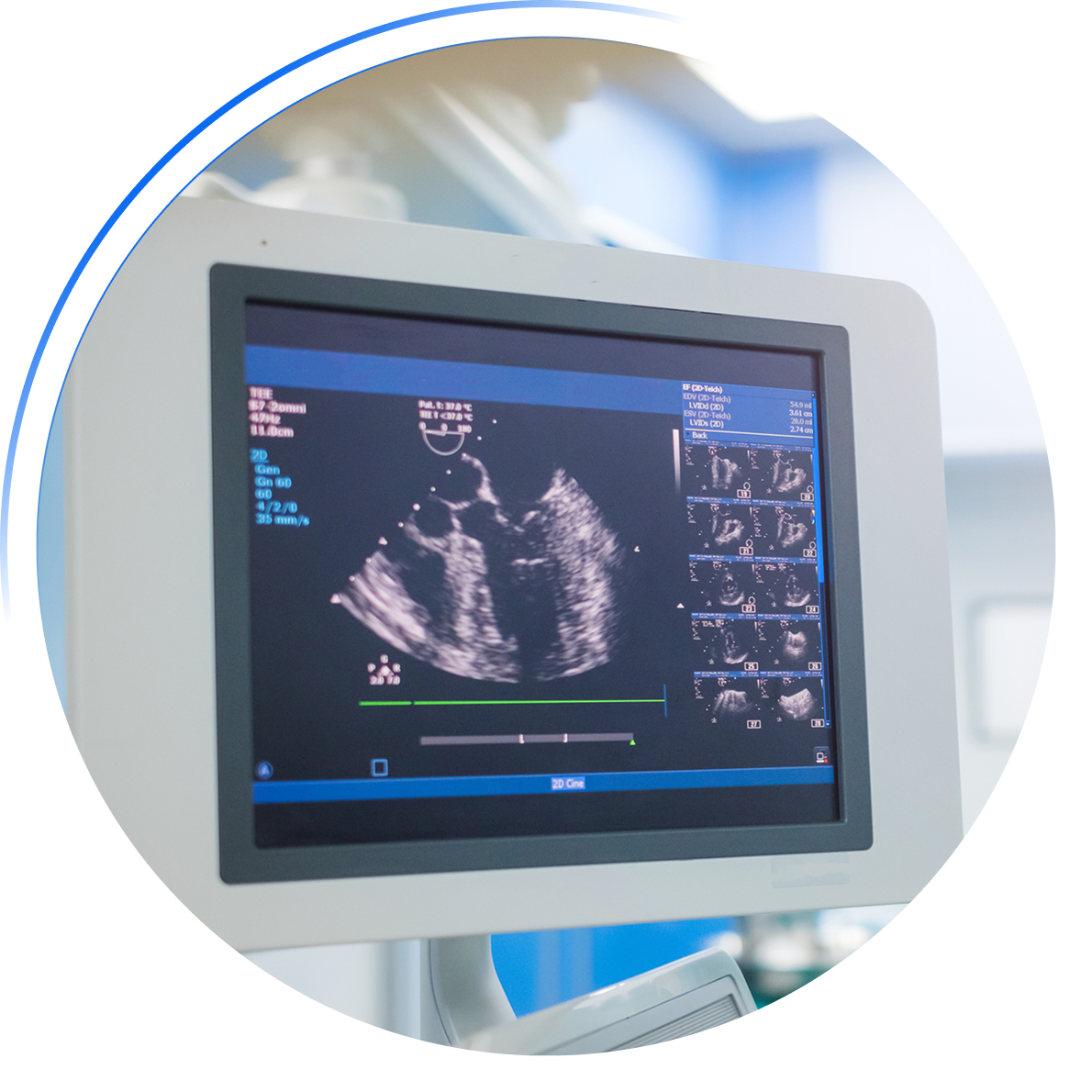 Fast, Accurate, and Convenient Ultrasounds Fast, Accurate, and Convenient Ultrasounds